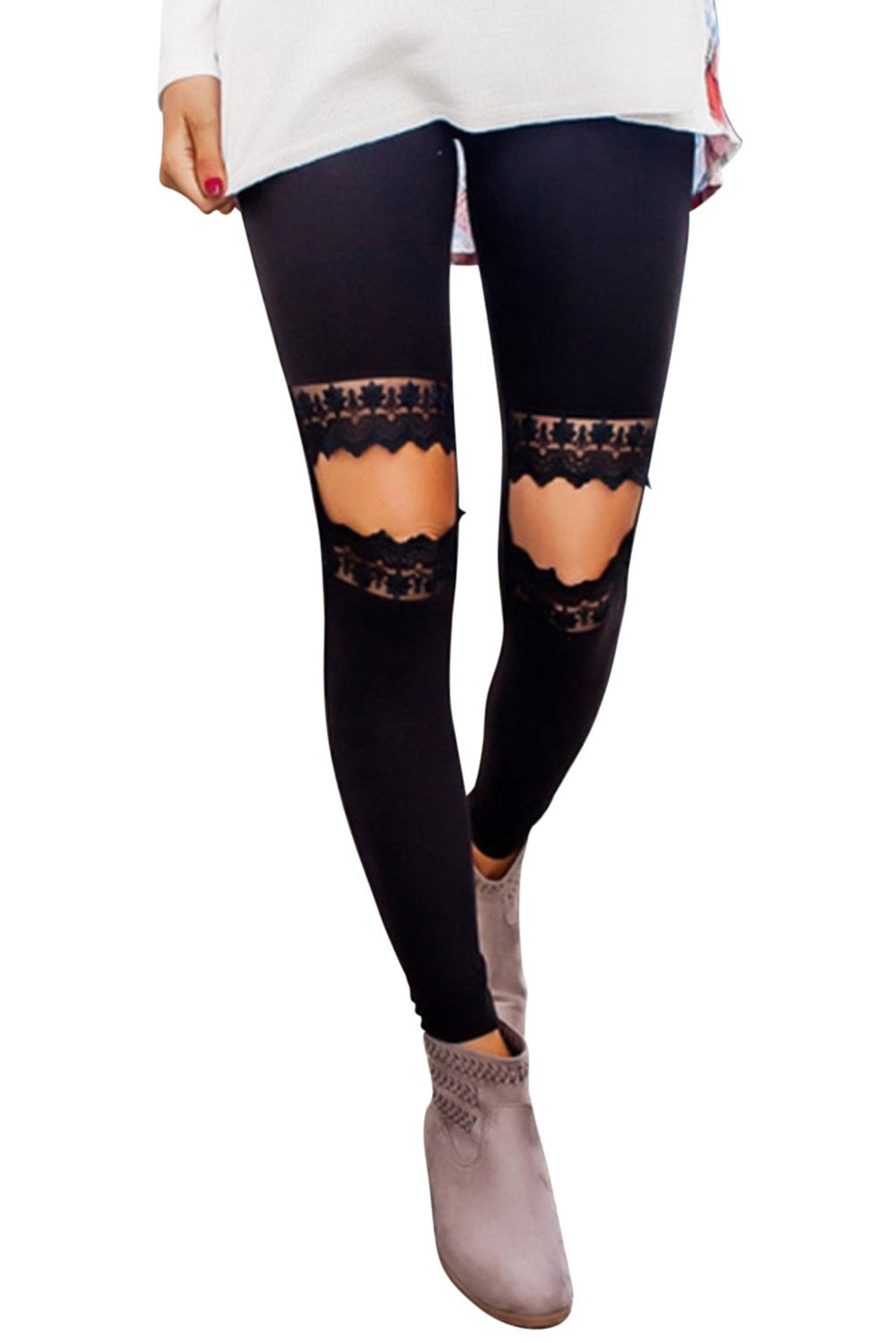 Cut Knee Lace Leggings